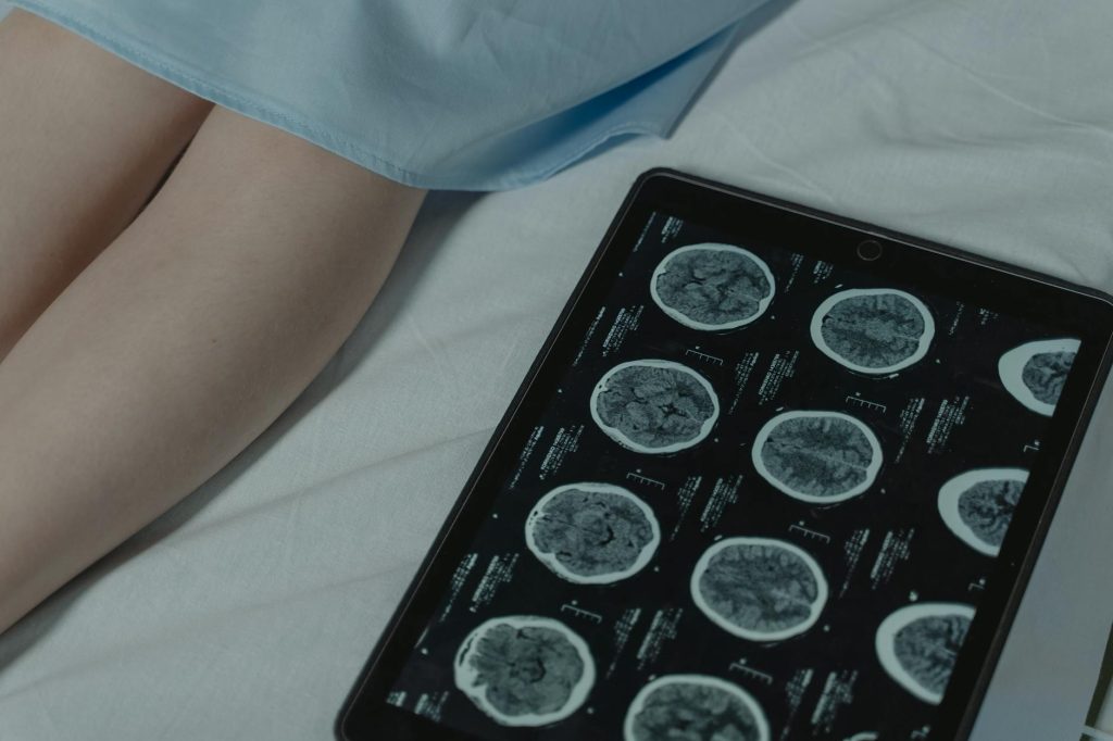 Brain Repair Medical Innovation